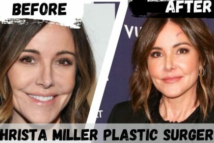 Christa Miller Plastic Surgery