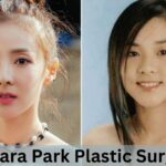 Sandara Park Plastic Surgery