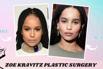 Zoe Kravitz Plastic Surgery