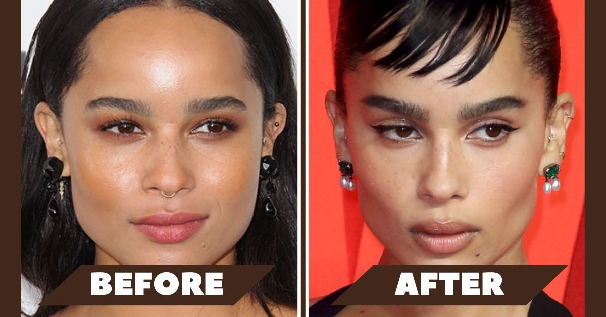 Zoe Kravitz Plastic Surgery