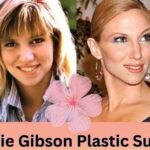 Debbie Gibson Plastic Surgery