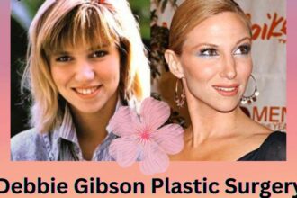 Debbie Gibson Plastic Surgery