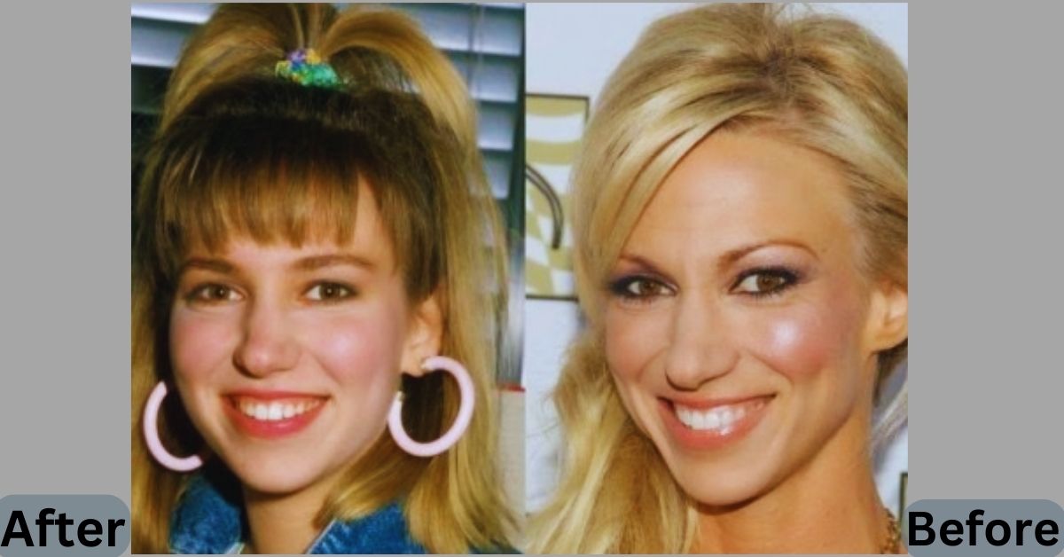 Debbie Gibson Plastic Surgery