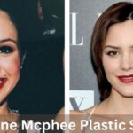 Katharine Mcphee Plastic Surgery