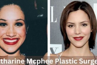 Katharine Mcphee Plastic Surgery