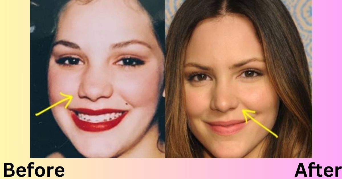 Katharine Mcphee Plastic Surgery