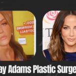 Kay Adams Plastic Surgery