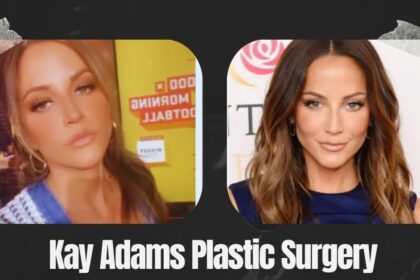 Kay Adams Plastic Surgery