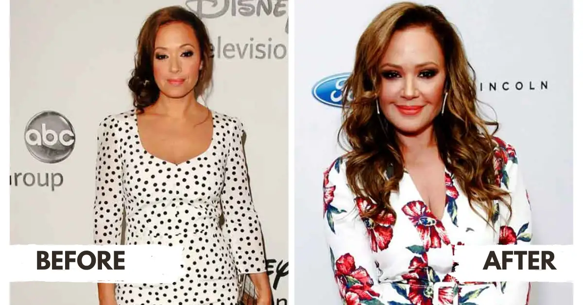 leah remini plastic surgery