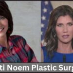 Kristi Noem Plastic Surgery