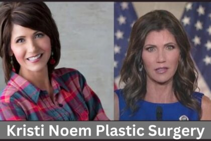 Kristi Noem Plastic Surgery