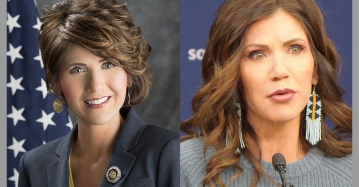 Kristi Noem Plastic Surgery