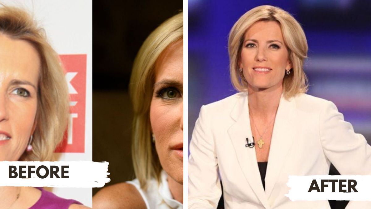 Laura Ingraham Before and After Photos